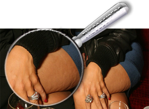 lentecellulite Cellulite da star