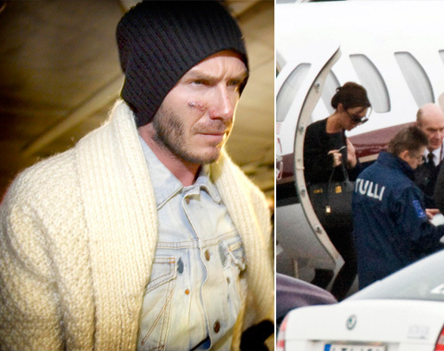 beckham ferito David Beckham è triste in Finlandia